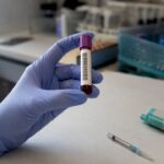 Eprubetă pentru recoltarea sângelui în vederea depistării carenței de fier