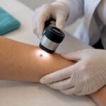 Dermatologul inspectează o aluniță cu dermatoscopul